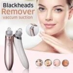 Xn 8030 Electric Blackhead Acne Oil Remover Vacuum 1 – Powerful Pimple